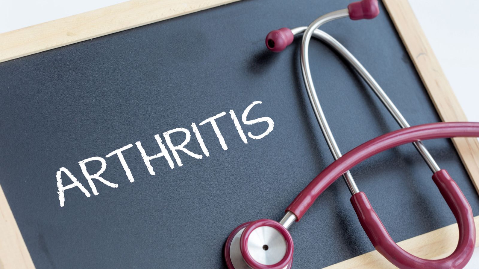 Arthritis