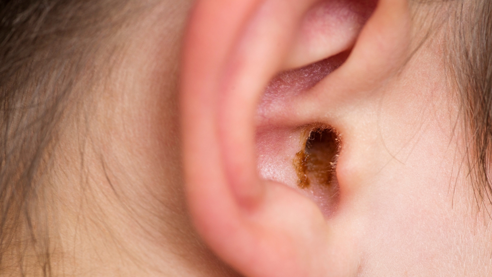 Ear wax