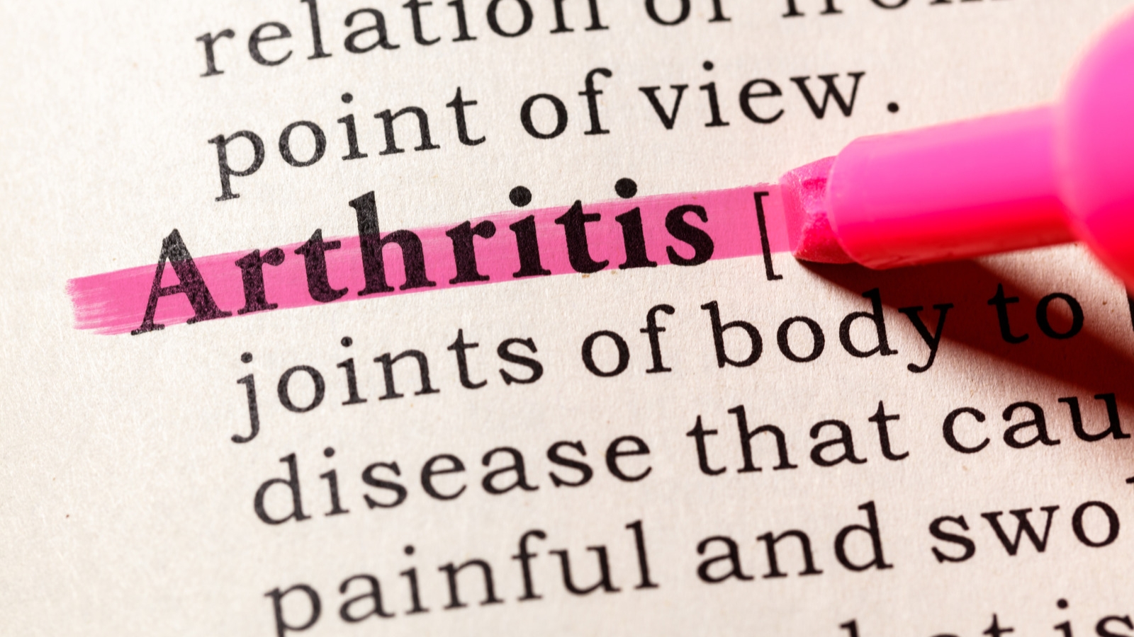 Arthritis